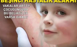 ABD’de Parvovirüs Vakaları %40 Arttı