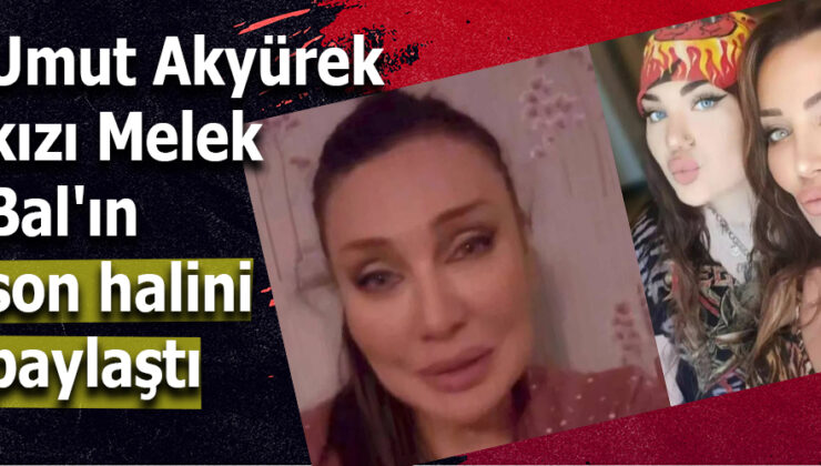 “Umut Akyürek, Kızı Melek Bal’ın Son Durumunu Sosyal Medyada Paylaştı”