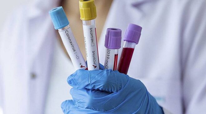 TTB’DEN SALGIN UYARISI: “BU YIL GRİP DAHA AĞIR GEÇECEK”